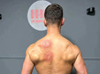 Electric Vacuum Cupping Massager